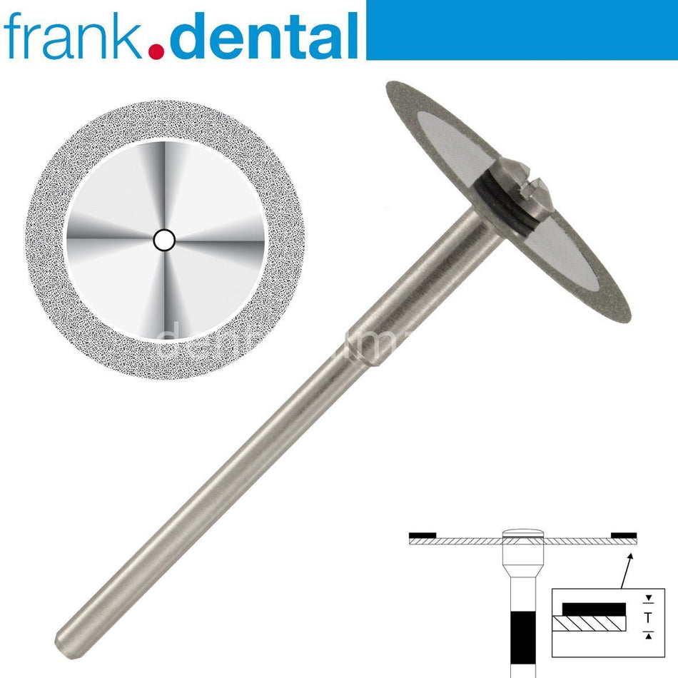 Frank Dental - Ortho Diamond Disc Interface Separe - Single Side Etching