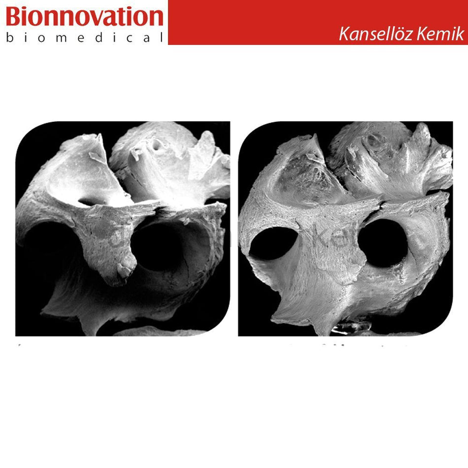 Bonefill Prous (Cancellous) Bovine Graft - Xenograft - 0,5gr (0.75 cc)