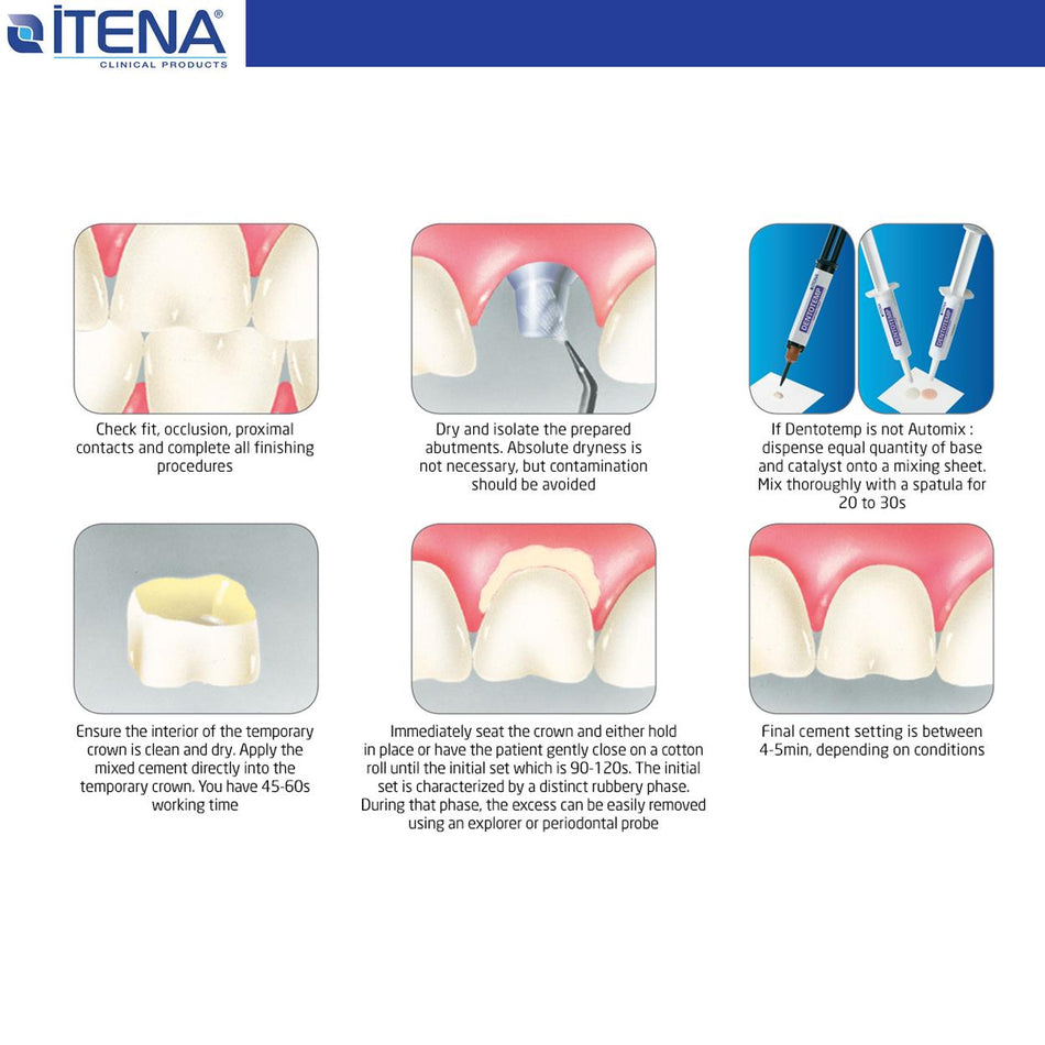 Dentotemp Long term temporary cement - Special implant - 1 Pcs