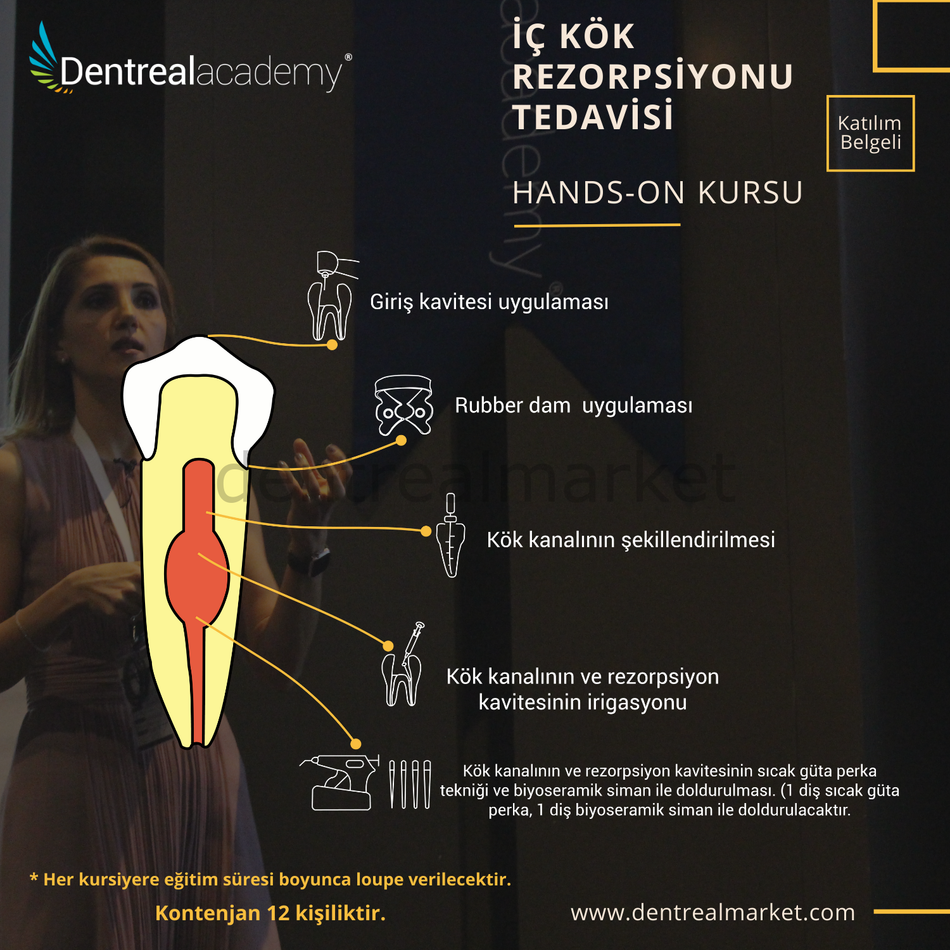 Inner Root Resorption Treatment Hands-On Course